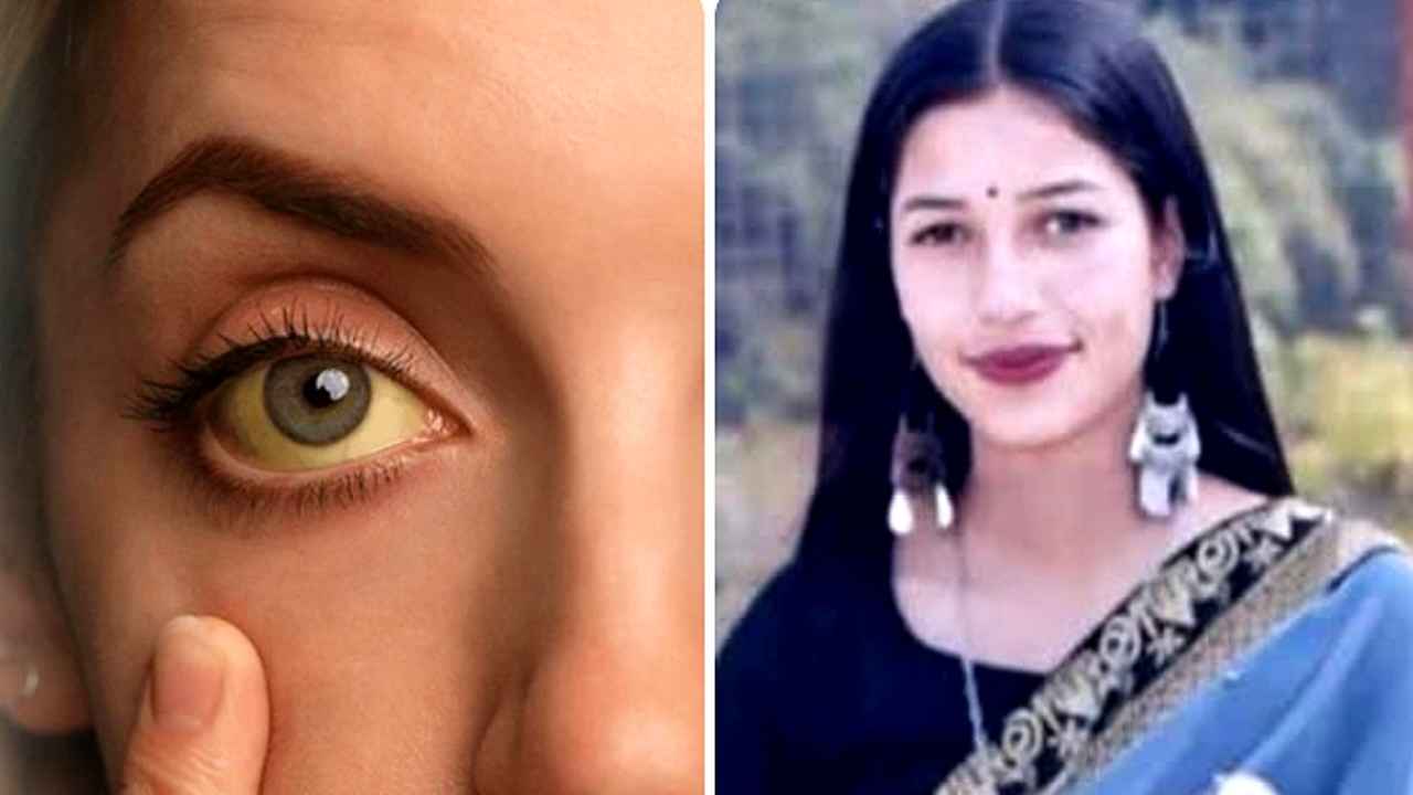‘सिस्टम की नाकामी या मौत का पानी…’ मंडी में पीलिया से 19 साल की नवविवाहिता की दर्दनाक मौत, प्रशासन पर फूटा गुस्सा! Death from jaundice