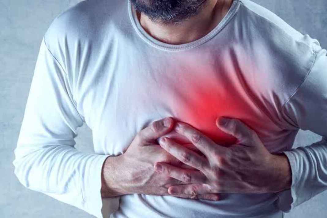 Heart Attack