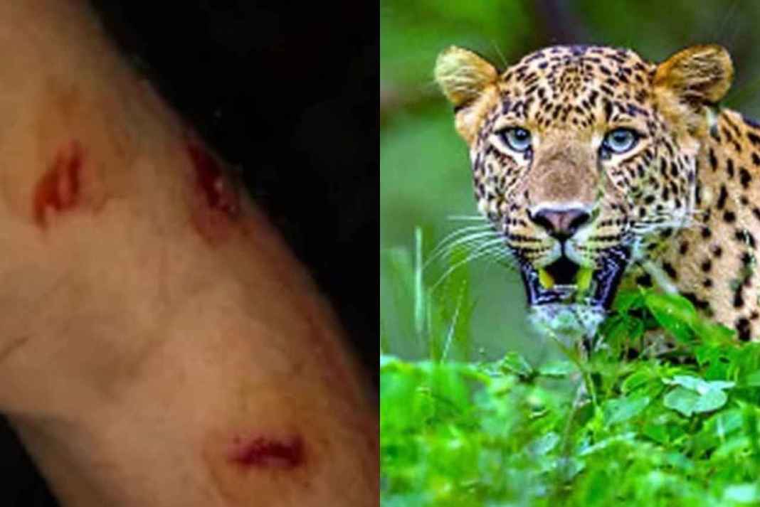 leopard attacked