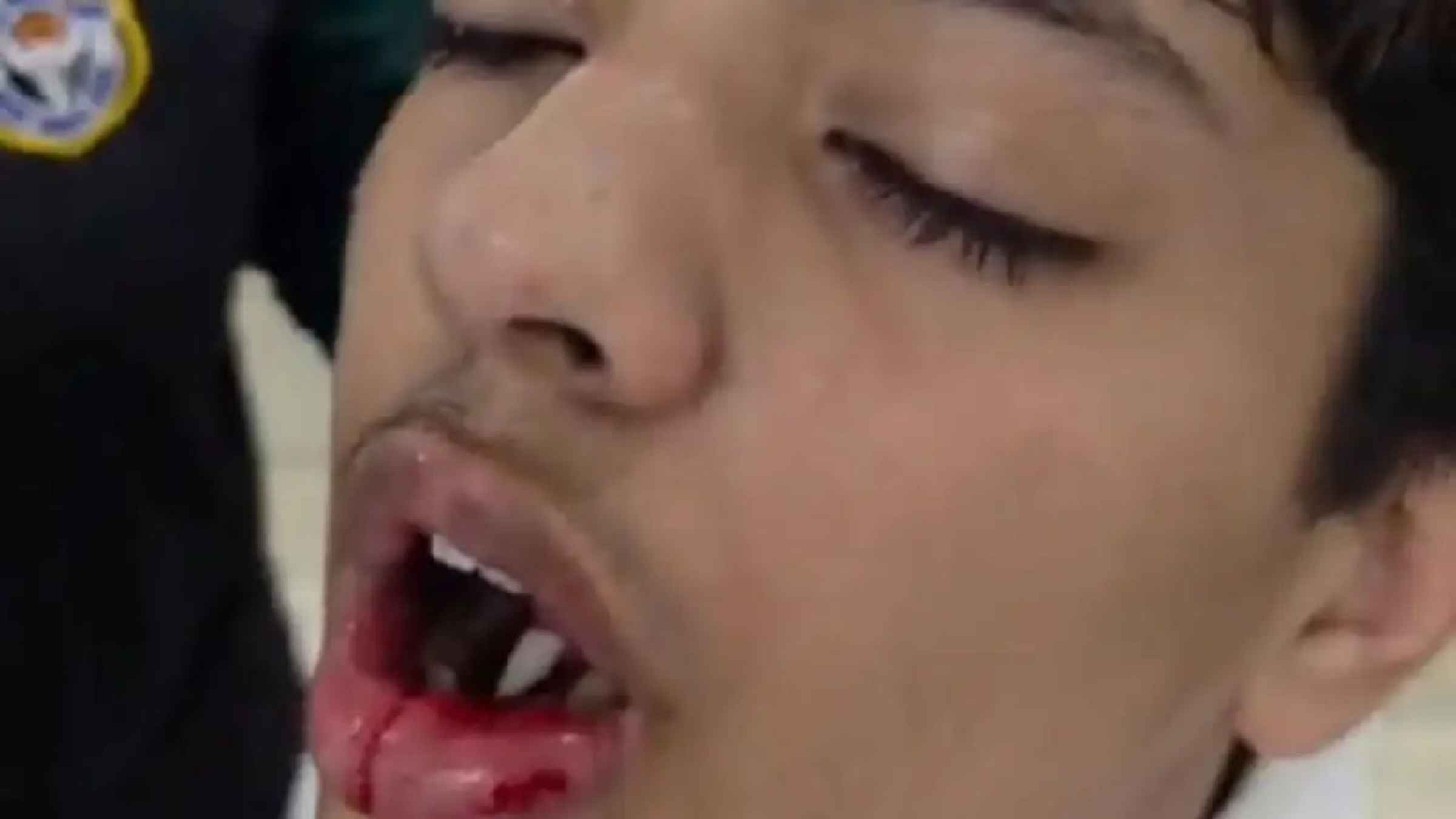 DPS में 10वीं के छात्र ने सहपाठी के मुंह पर बरसाए घूंसे, 4 दांत तोड़े, 3 महीने तक नहीं खुलेगा मुंह, पिता बोले- स्कूल प्रबंधन भी है साजिश में शामिल DPS School student attack