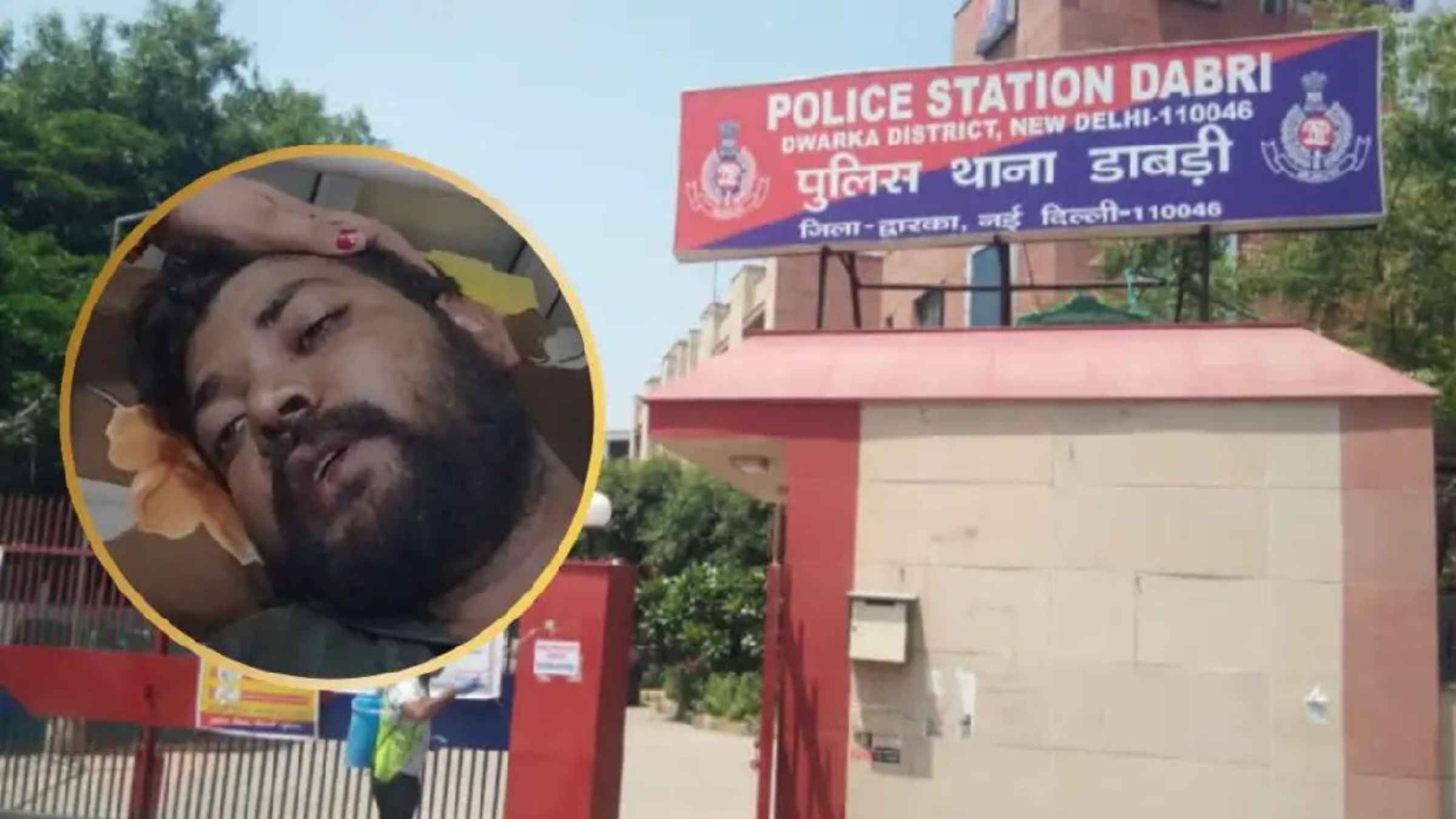 बेटी की शादी का 2 लाख रुपये का बिल मांगने गए हलवाई के हाथ ग्राइंडर से काटे, डाबरी में हैवानियत की हद पार, एम्स में जिंदगी-मौत से जूझ रहा पीड़िता Delhi crime Dabri murder