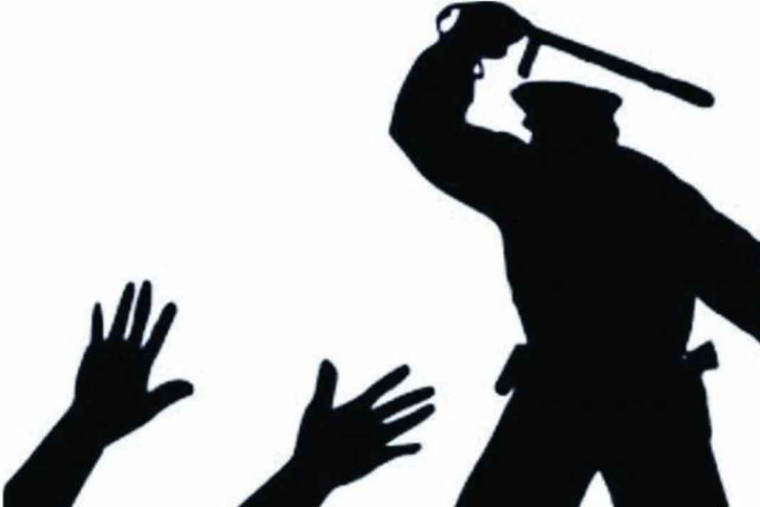Police Remand