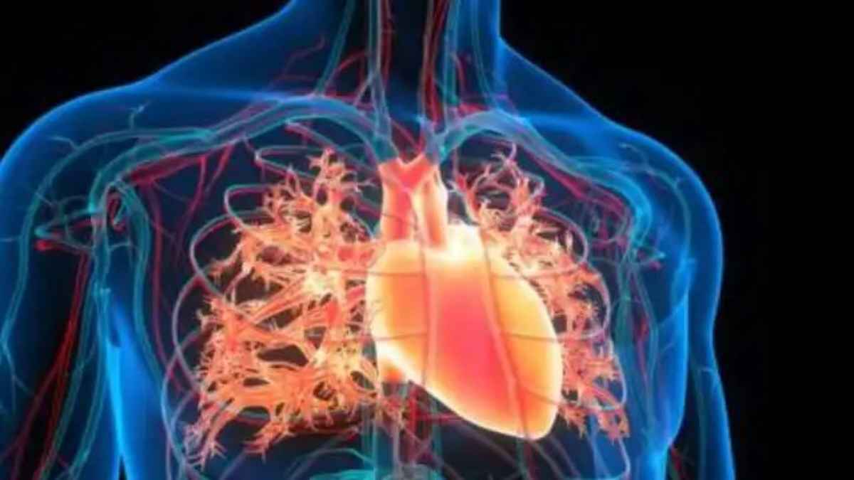 HeartAttackRecovery