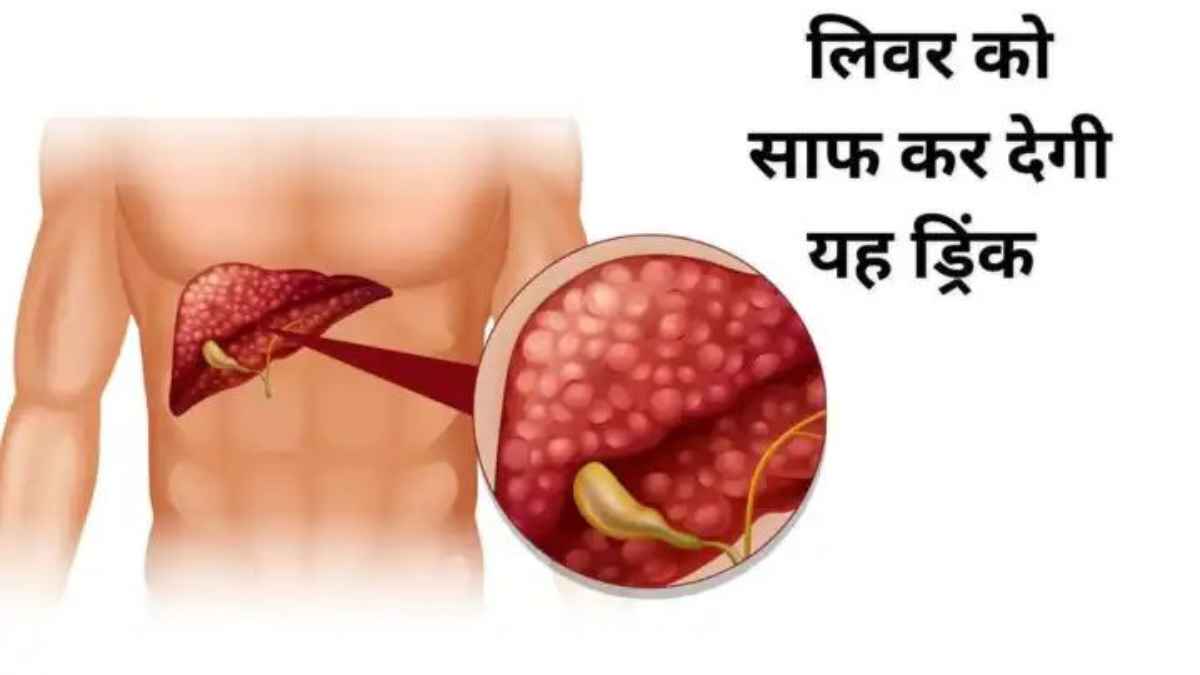LiverDetox