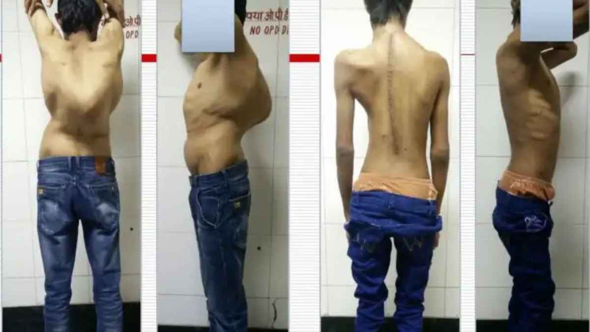 SpineSurgery