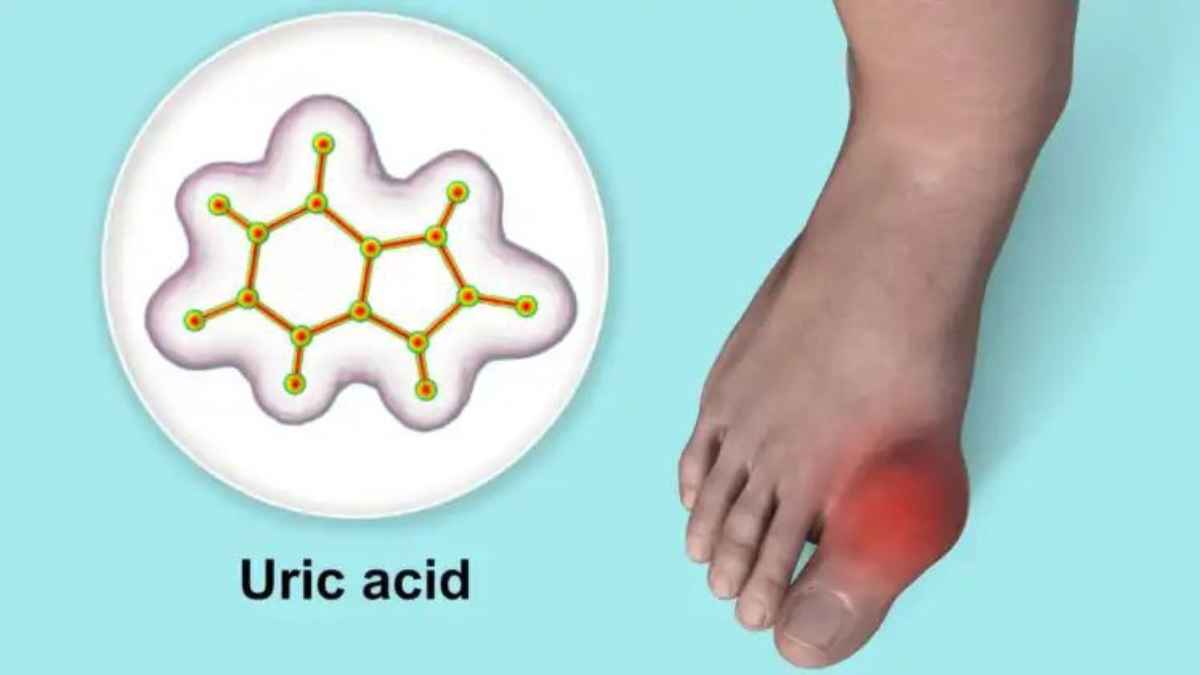 सावधान! क्या आप भी मसल्स बनाने के लिए खा रहे हैं अंधाधुंध प्रोटीन? शरीर में बन सकता है यूरिक एसिड का भयंकर तेजाब UricAcidControl
