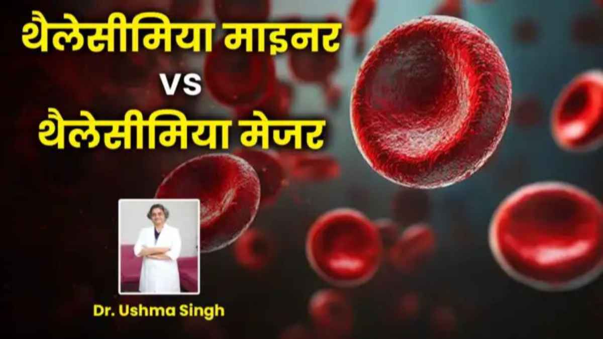 थैलेसीमिया माइनर और मेजर: क्या है अंतर और कैसे करें बचाव? जानें स्वास्थ्य विशेषज्ञों की राय thalassemia-minor-vs-major